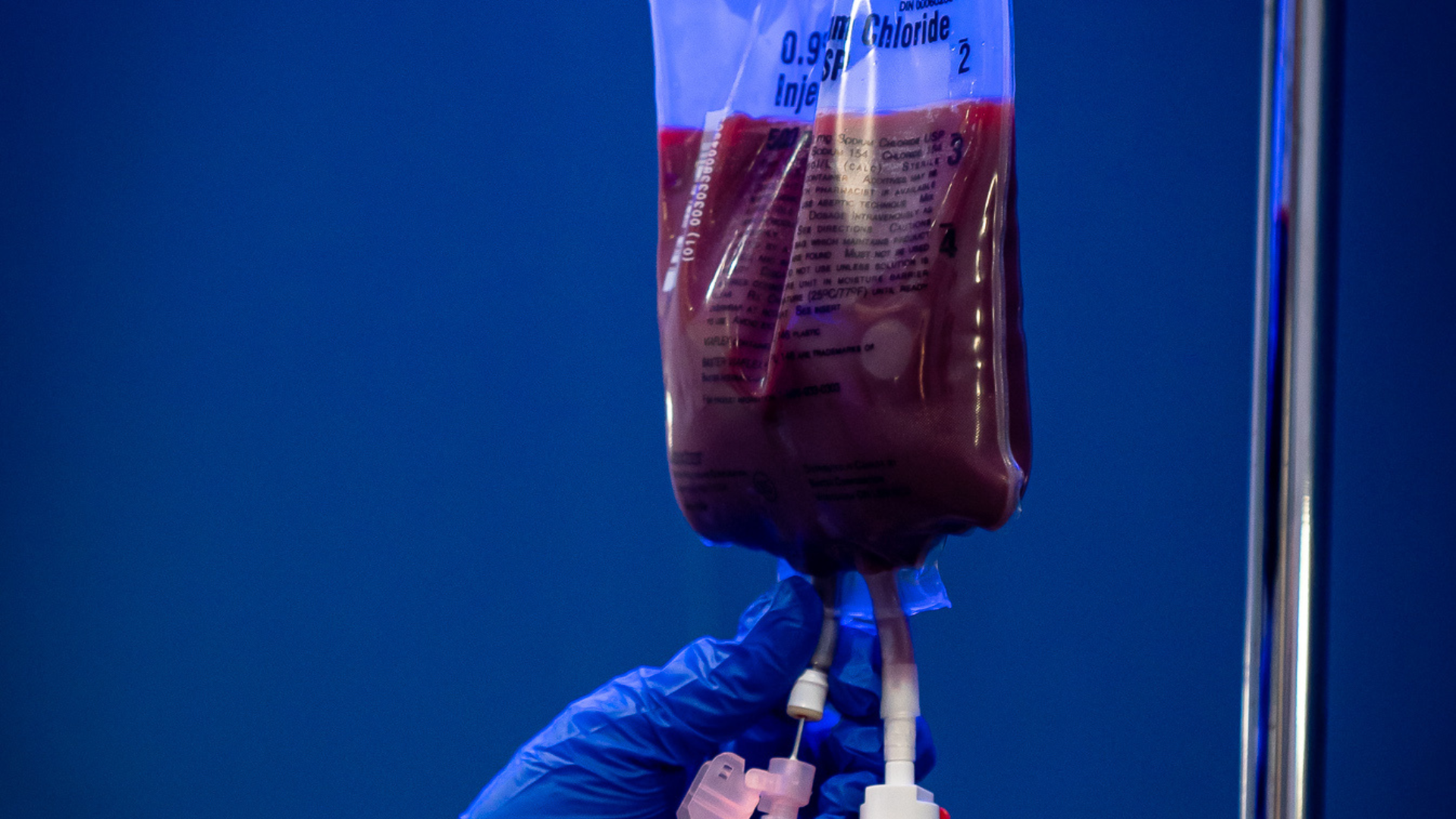 Ozone UV IV Therapy