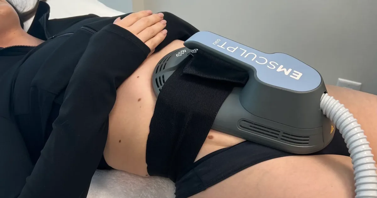 EMSCULPT NEO vs CoolSculpting comparison for stubborn fat at iCRYO Daniel Island