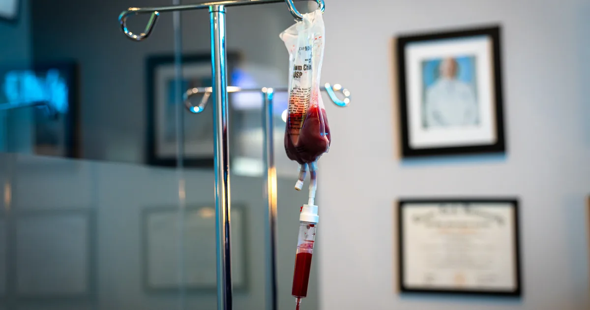 Ozone UV IV compared with a standard vitamin IV drip at iCRYO Daniel Island