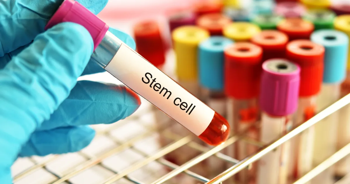 Comparing stem cell IV therapy and PRP regenerative options at iCRYO Daniel Island